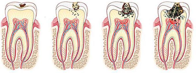clinica dental talaver valles